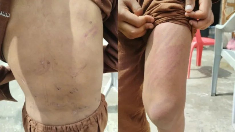 Teacher Beats 9‑Year‑Old at Kishtwar Madrasa; Boy Found 30 km Away