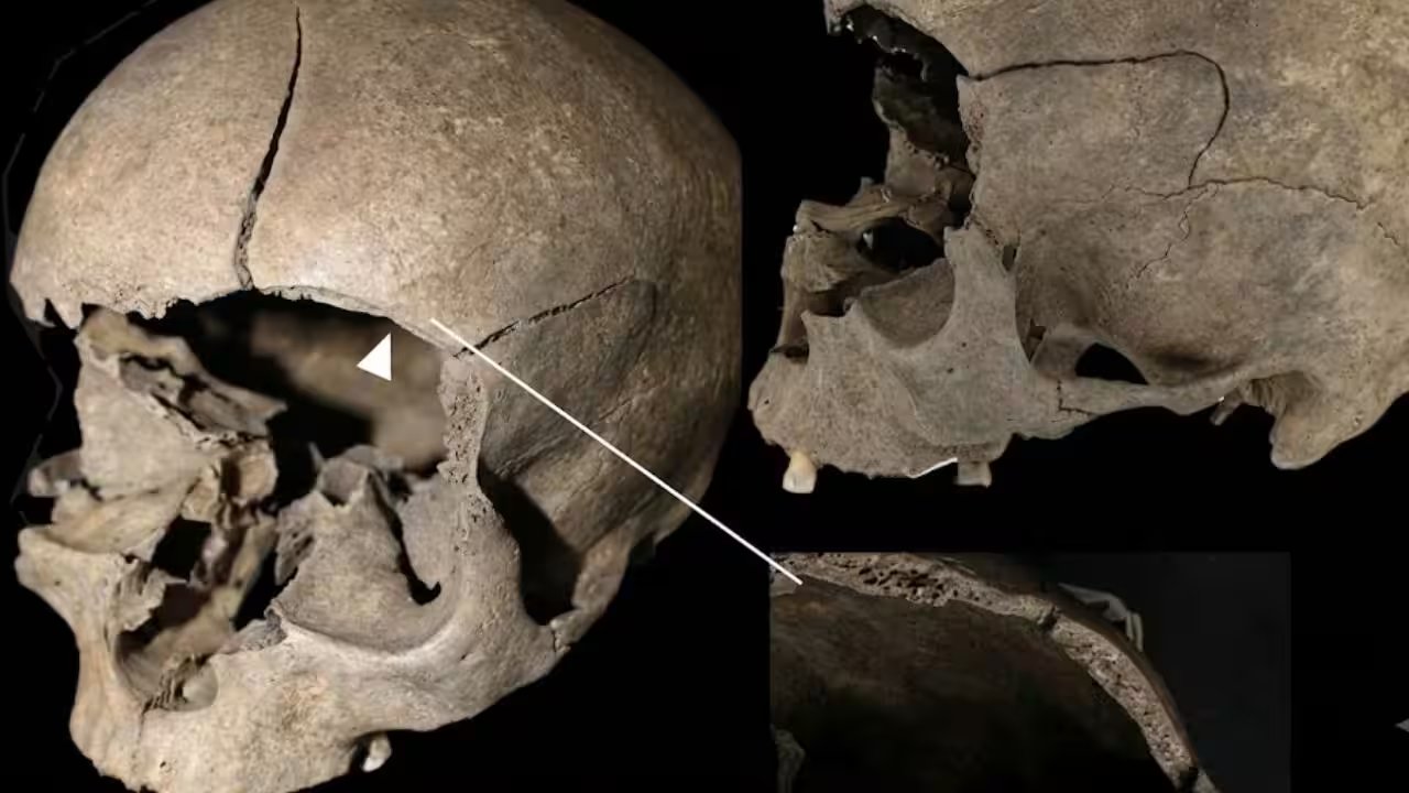 Scandinavia's Archaeologists Find 19 Injuries in 12 Iron Age Remains