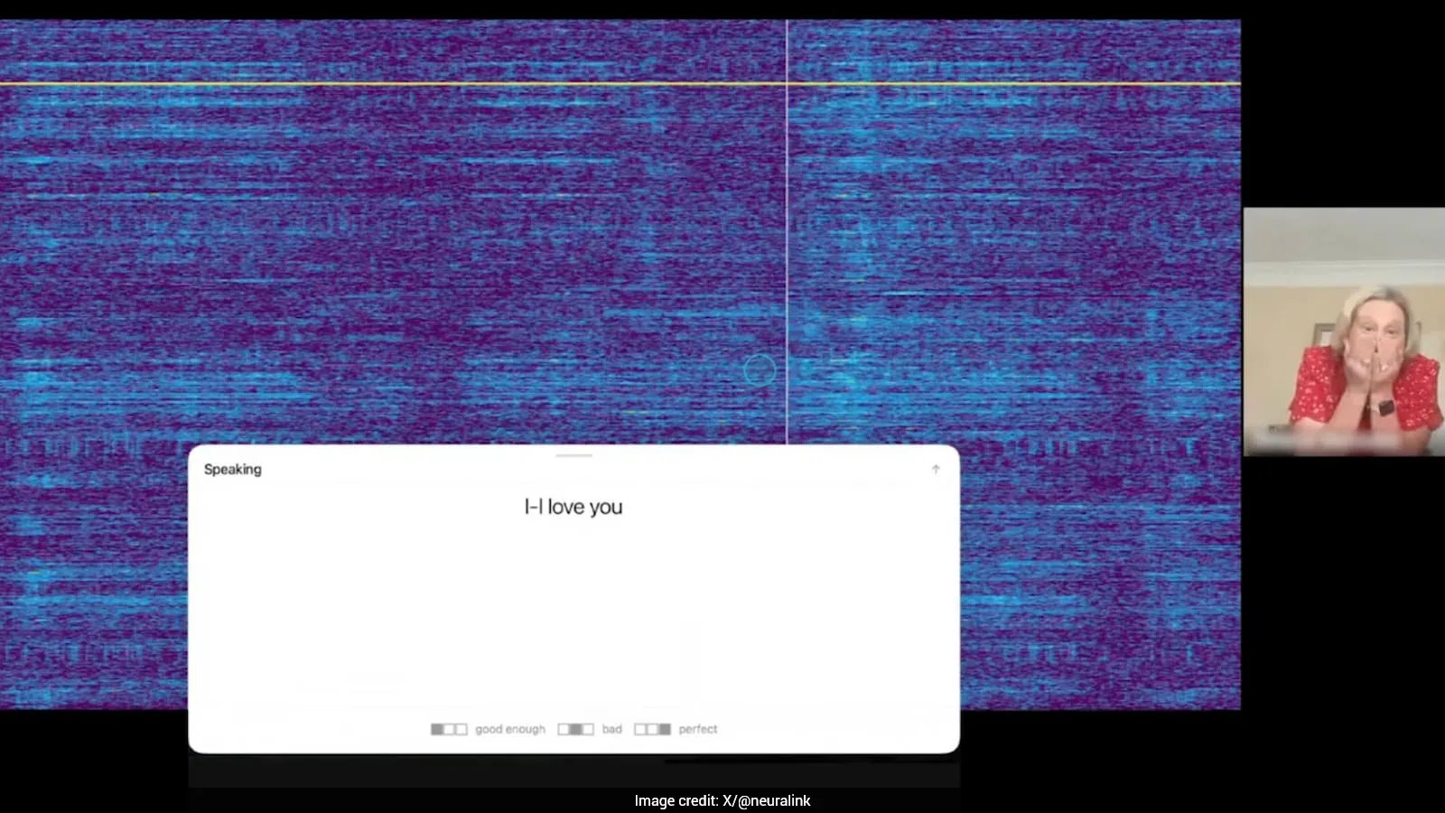 Brain‑Computer Implant Lets Speech‑Impaired Man Say "I Love You"