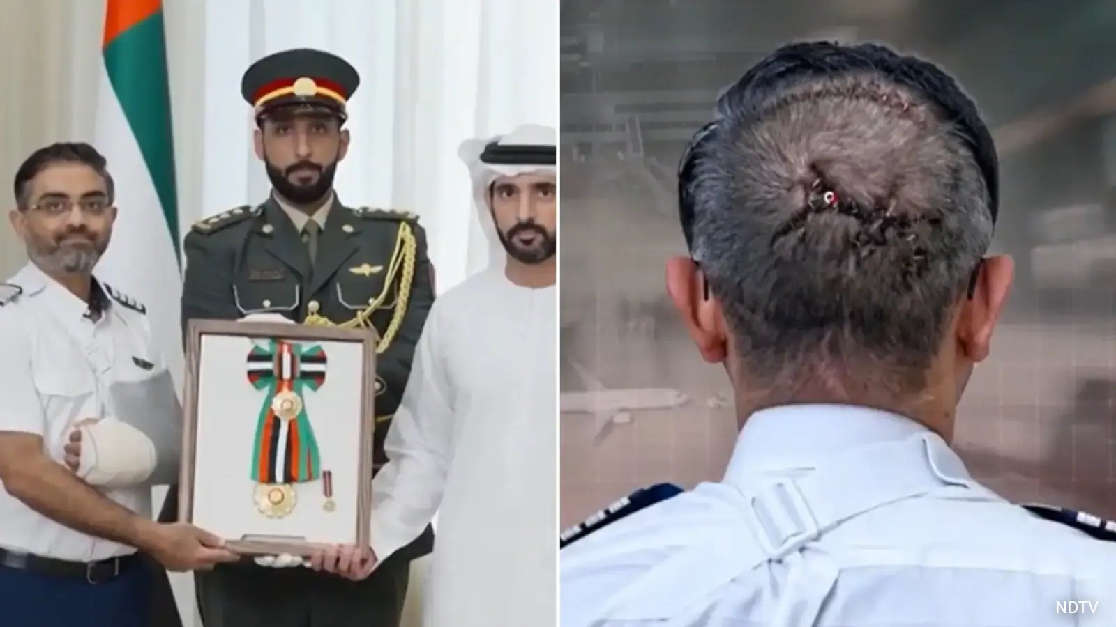 UAE President Awards flydubai Captain Smit Machchhar, Revealing Head Stitches