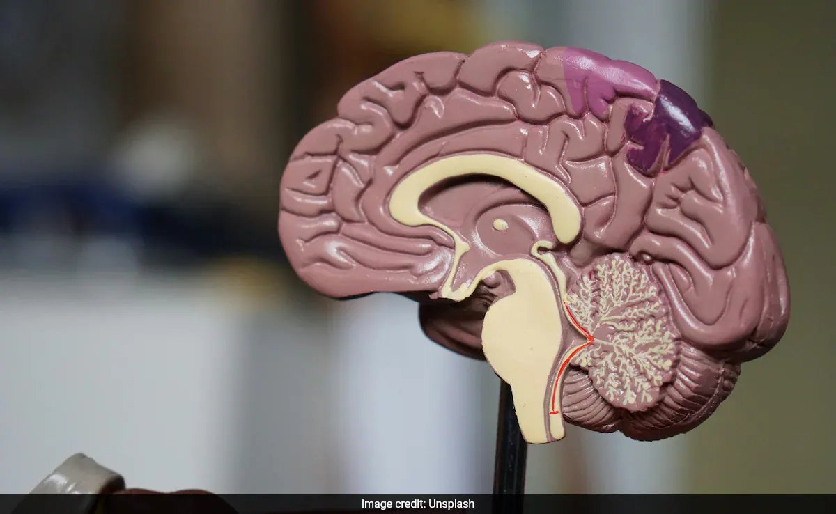 IIT Madras Maps 100 Human Brains from Fetus to 85‑Year‑Old