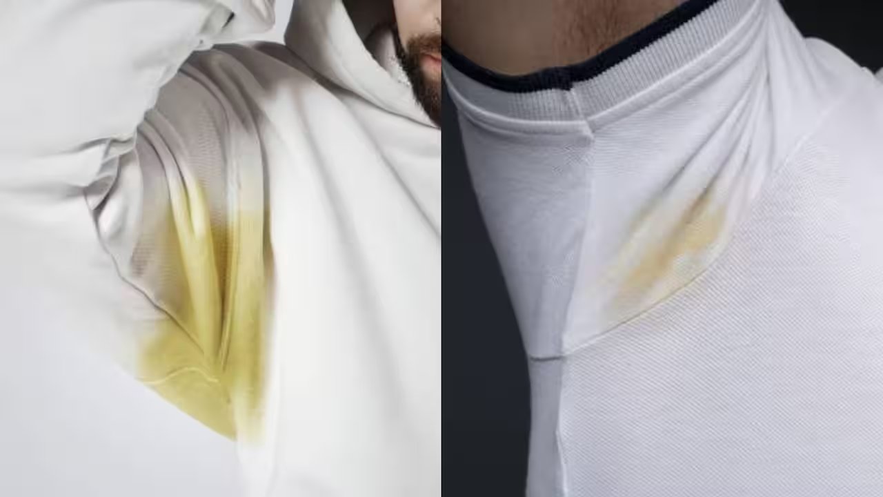 Baking Soda Paste: The Simple Home Fix for Yellow Stains on White Shirts