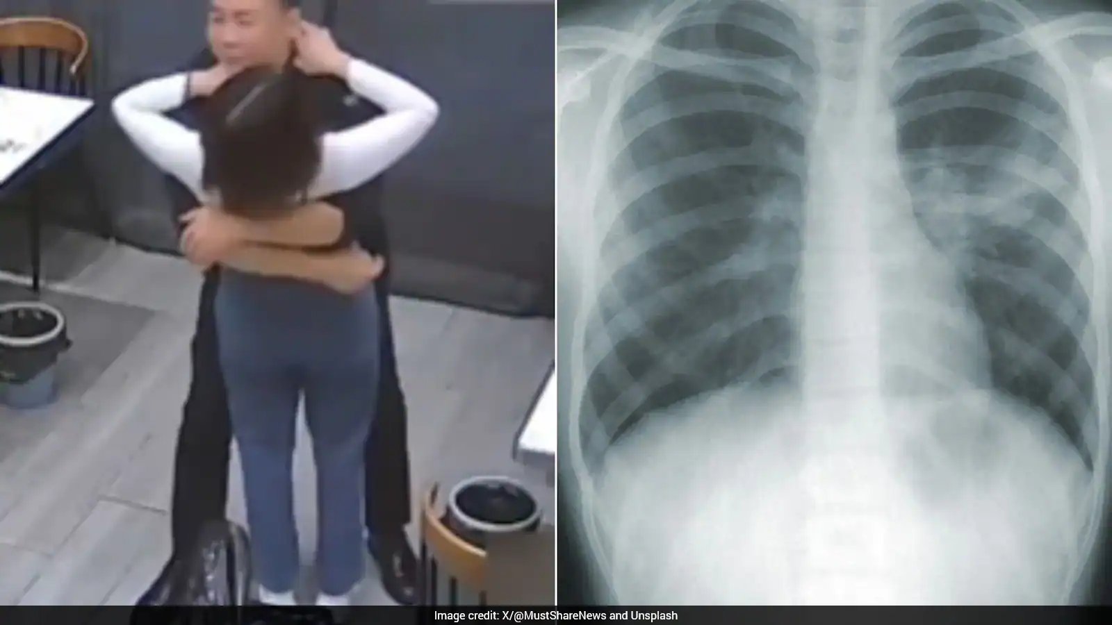 Wang’s Hug Causes Wife’s Five Ribs to Break on Oct. 19