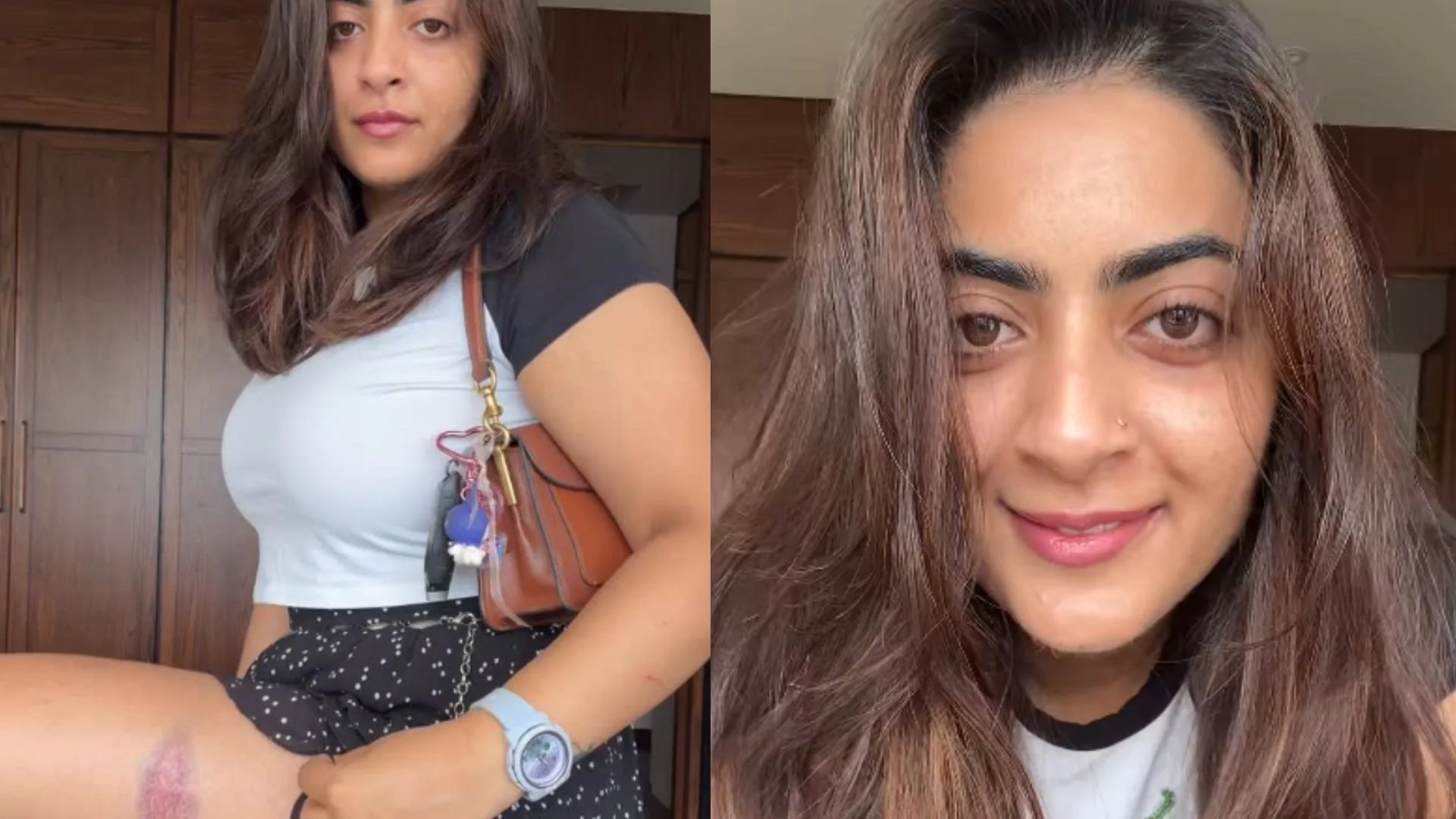 Zayn Marie Shares Injury Photos After Mumbai Police Detention