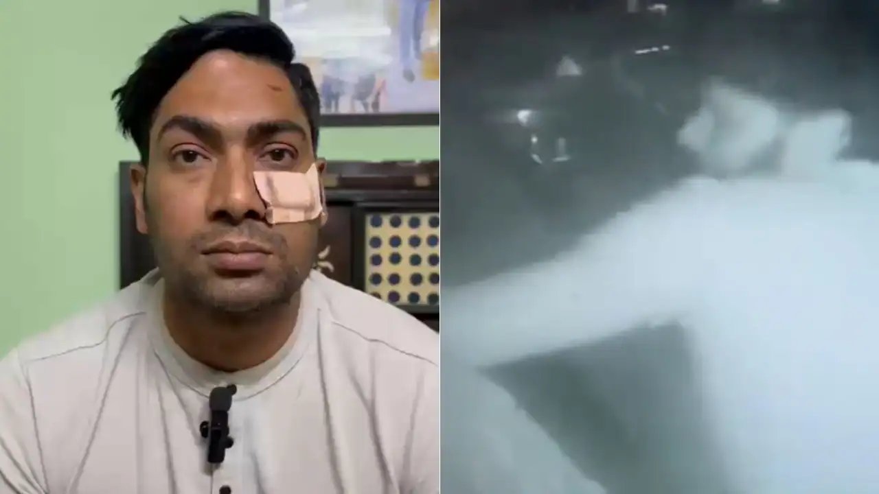 Delhi Constable Krishna Beaten With Baseball Bat in Mangolpuri, Gets 5 Stitches