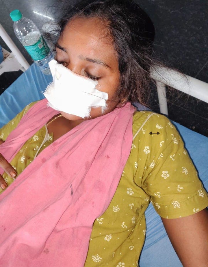 Enagandla Manichander Bites Wife's Nose in Kotapalli Mandal, Telangana